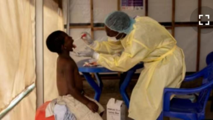 WHO Nyatakan Mpox Darurat Kesehatan Global