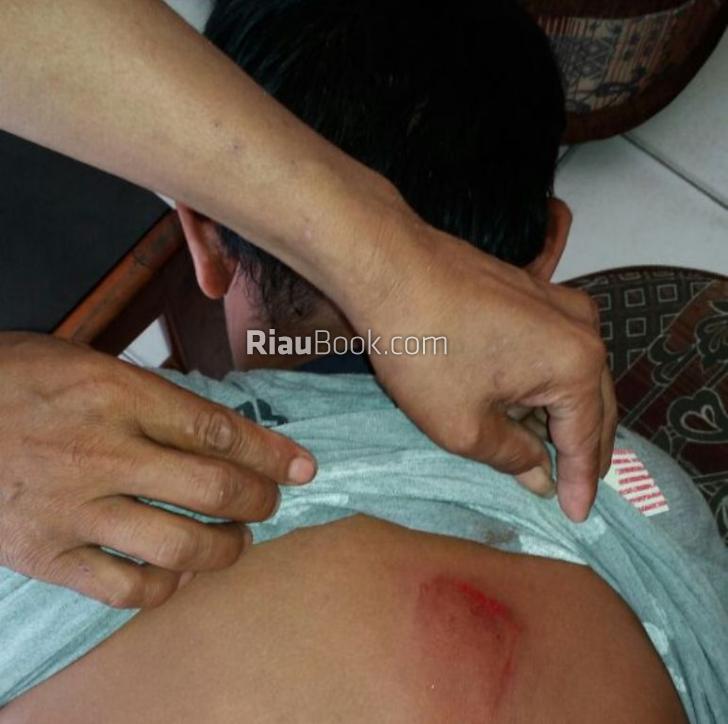 Asik Ukur Tanah, Pria Ini Tiba-tiba Diserang dengan Kayu Broti