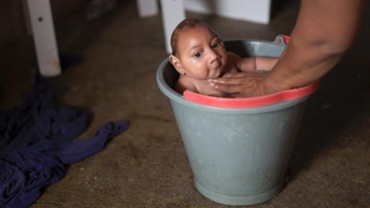 Peringatan Bagi Wanita Hamil, Hindari Hubungan Seksual Kalau Tak Mau Kena Virus Zika