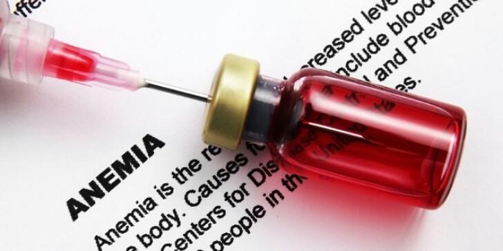Kenali dan Obati, Ini Penyebab Manusia Diserang Anemia